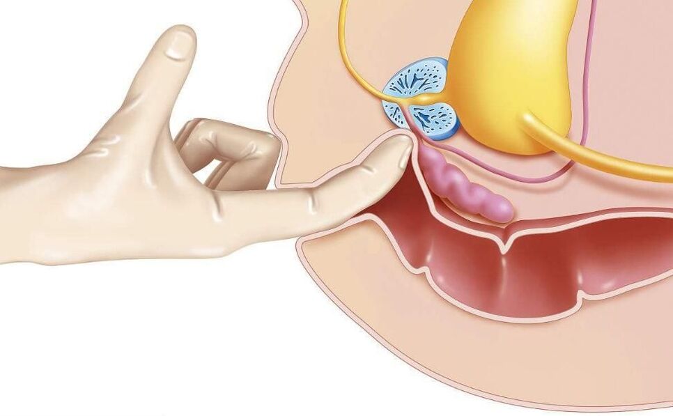 Masaj de prostată pentru tratamentul prostatitei